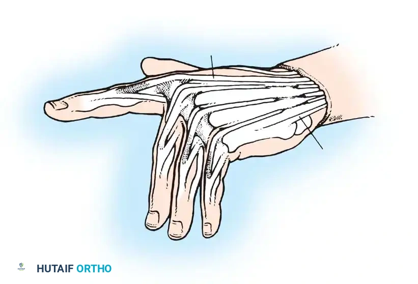 Hutaifortho's Orthopaedic Diagram