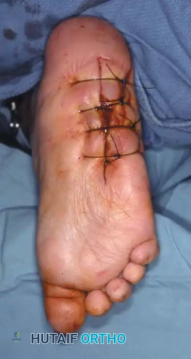 Hutaifortho's Orthopaedic Diagram