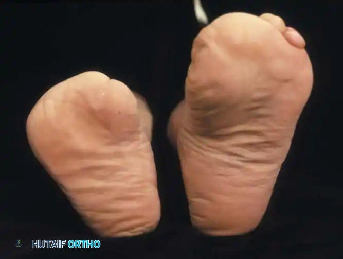 Hutaifortho's Orthopaedic Diagram