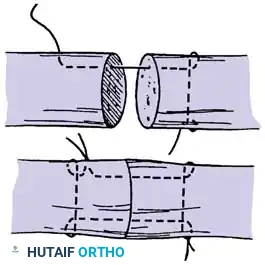 Hutaifortho's Orthopaedic Diagram