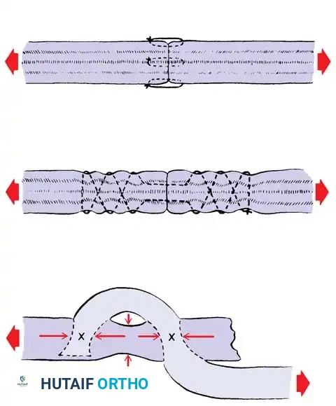 Hutaifortho's Orthopaedic Diagram
