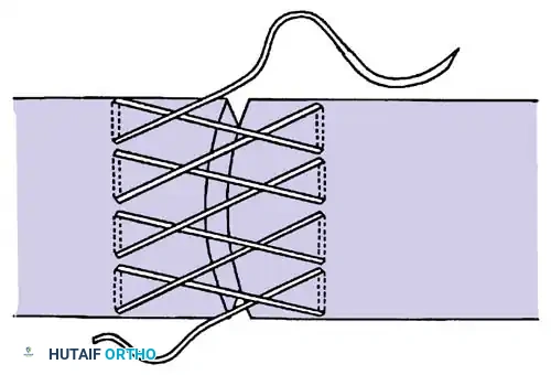 Hutaifortho's Orthopaedic Diagram