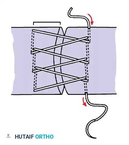 Hutaifortho's Orthopaedic Diagram