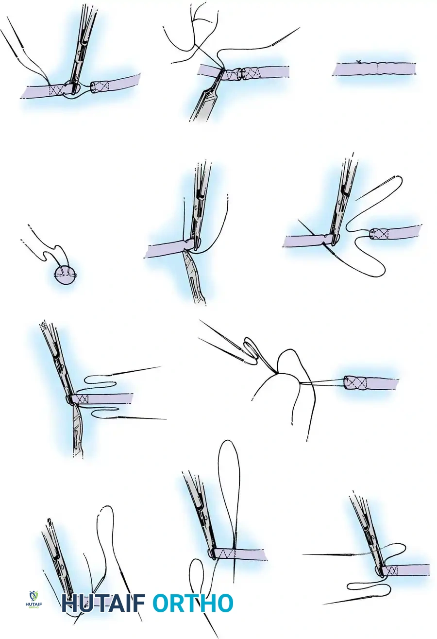 Hutaifortho's Orthopaedic Diagram