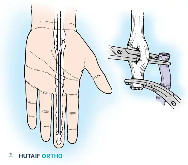 Hutaifortho's Orthopaedic Diagram