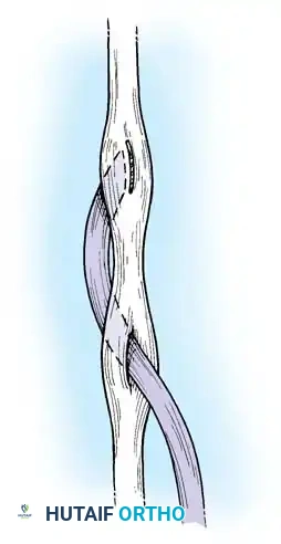 Hutaifortho's Orthopaedic Diagram