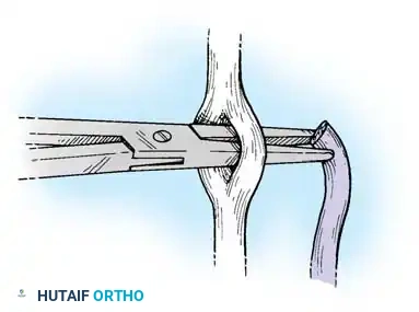 Hutaifortho's Orthopaedic Diagram