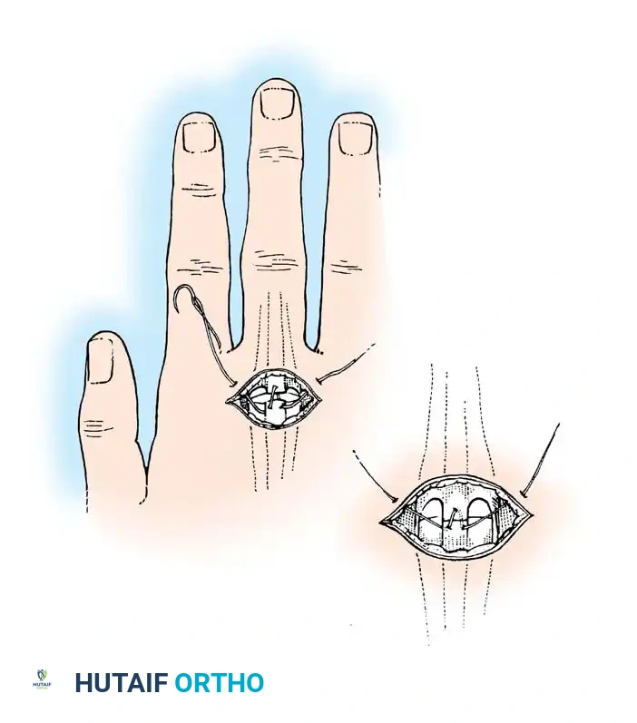 Hutaifortho's Orthopaedic Diagram