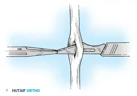 Hutaifortho's Orthopaedic Diagram