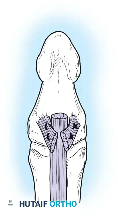 Hutaifortho's Orthopaedic Diagram