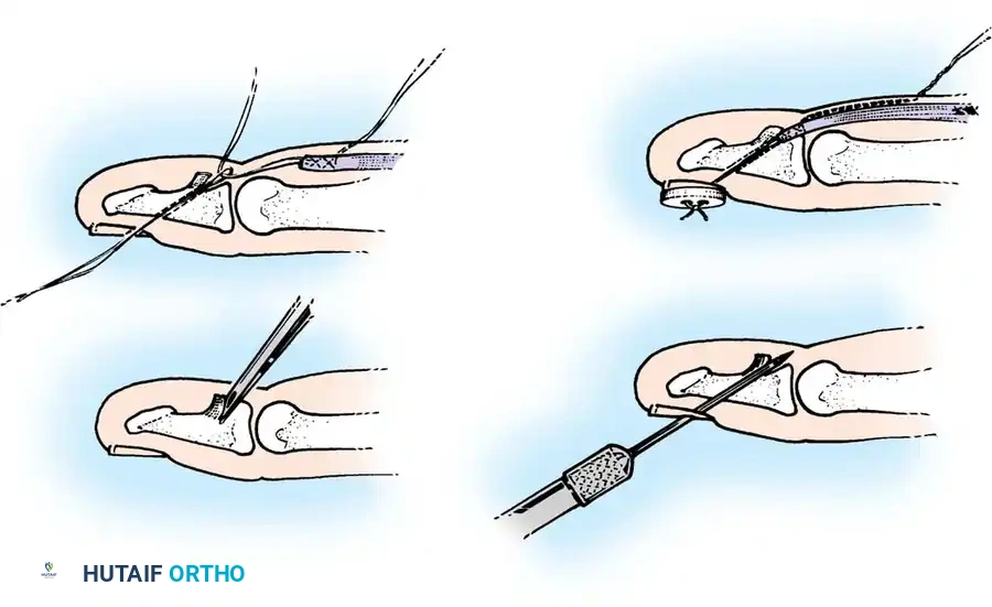 Hutaifortho's Orthopaedic Diagram
