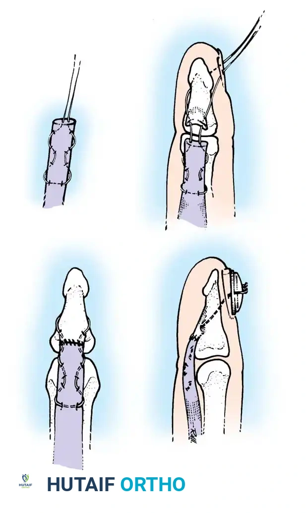 Hutaifortho's Orthopaedic Diagram