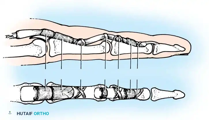 Hutaifortho's Orthopaedic Diagram