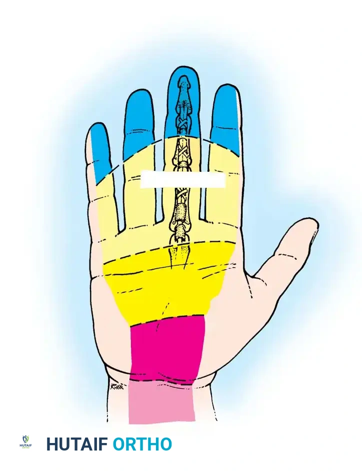 Hutaifortho's Orthopaedic Diagram