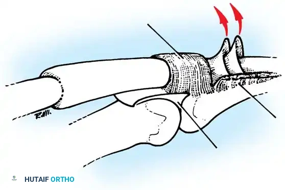 Hutaifortho's Orthopaedic Diagram