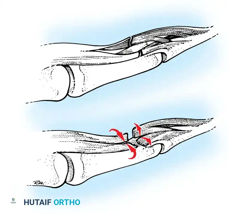 Hutaifortho's Orthopaedic Diagram