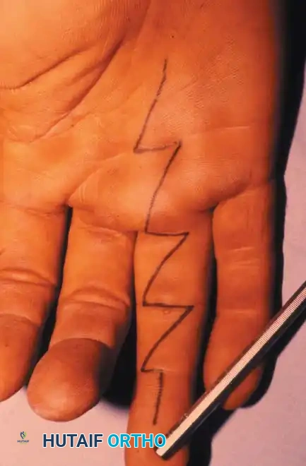 Hutaifortho's Orthopaedic Diagram