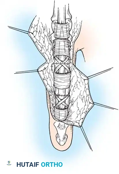 Hutaifortho's Orthopaedic Diagram