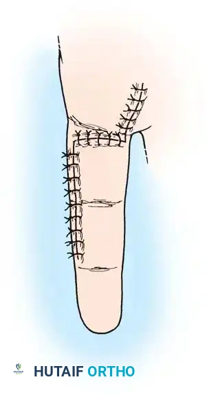 Hutaifortho's Orthopaedic Diagram