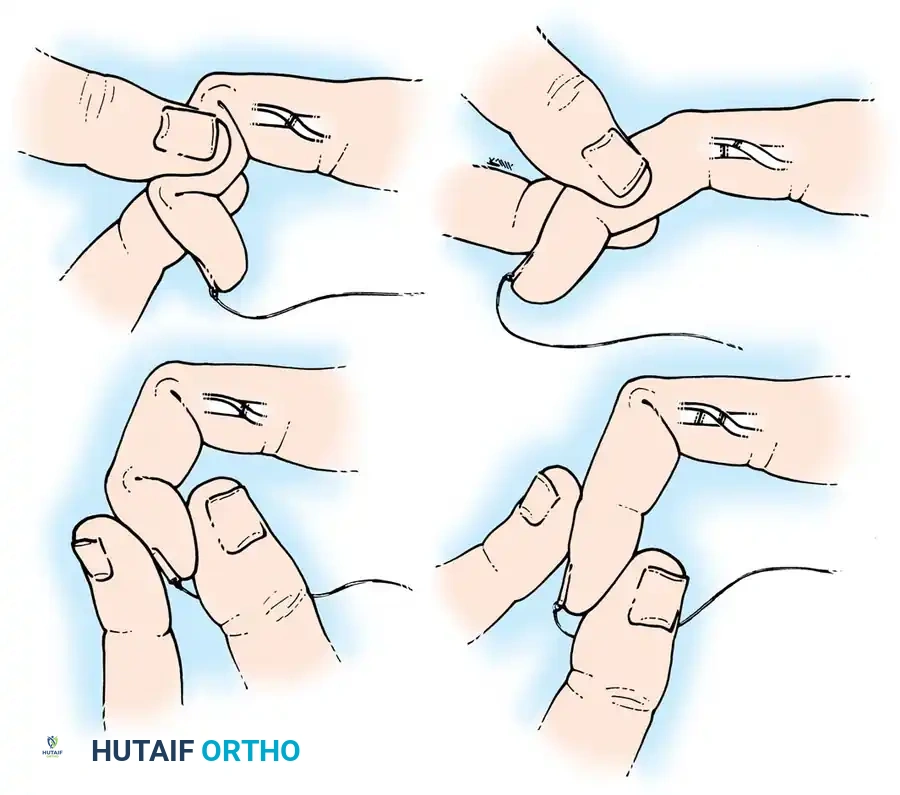 Hutaifortho's Orthopaedic Diagram