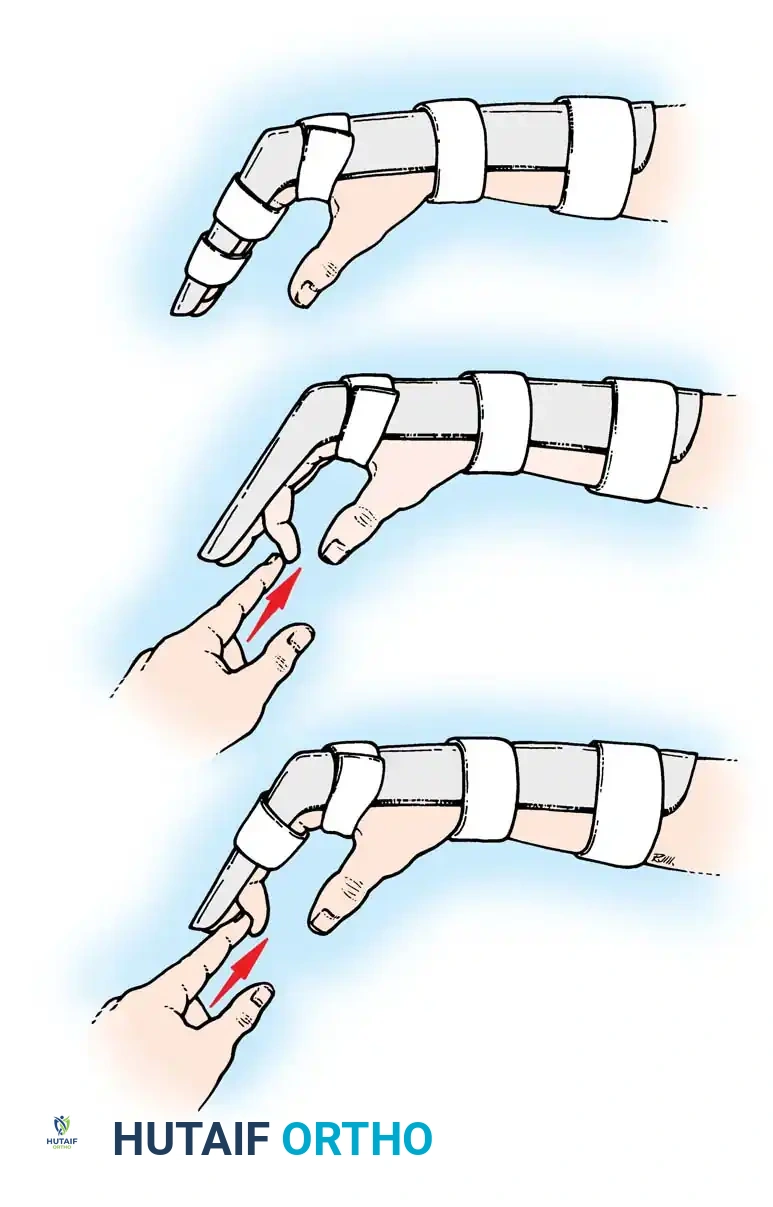 Hutaifortho's Orthopaedic Diagram