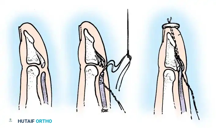 Hutaifortho's Orthopaedic Diagram