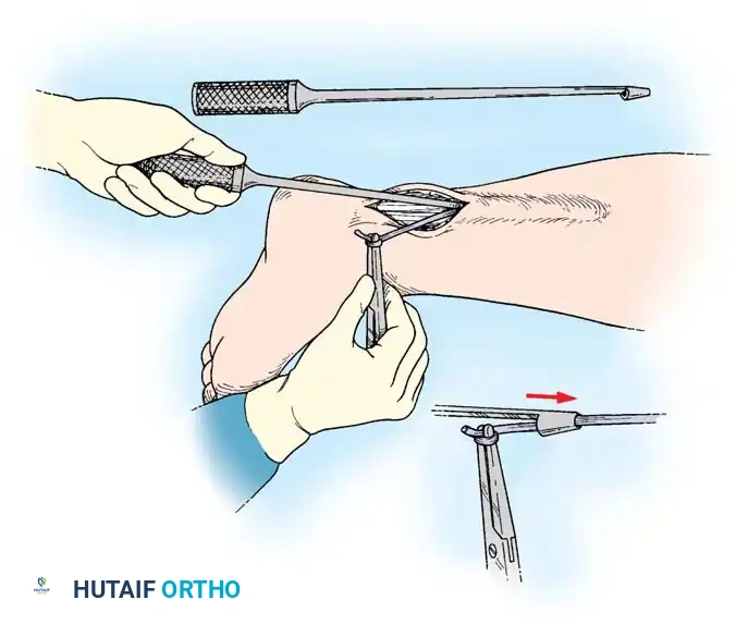 Hutaifortho's Orthopaedic Diagram