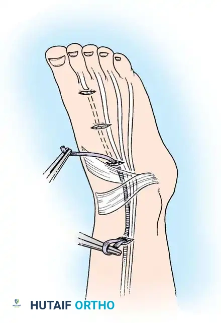 Hutaifortho's Orthopaedic Diagram