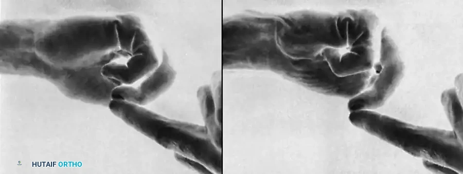 Hutaifortho's Orthopaedic Diagram