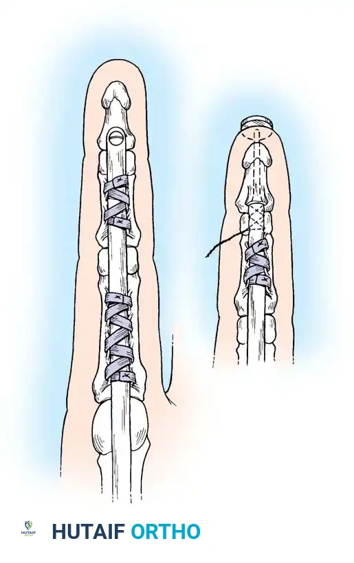 Hutaifortho's Orthopaedic Diagram