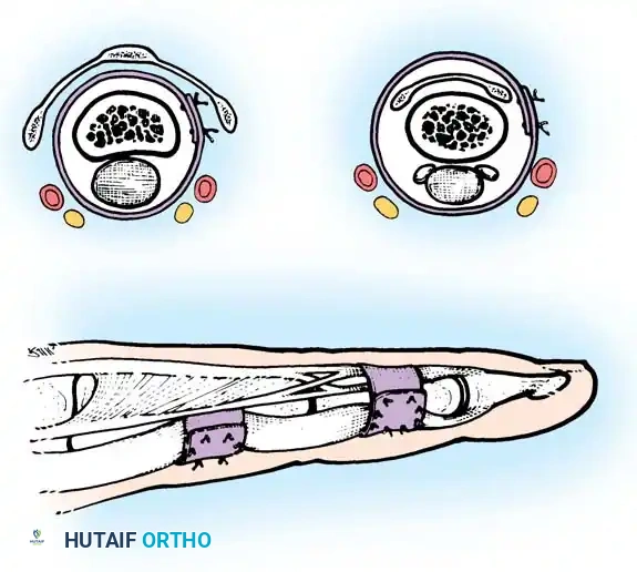 Hutaifortho's Orthopaedic Diagram