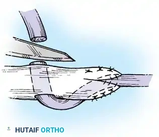 Hutaifortho's Orthopaedic Diagram