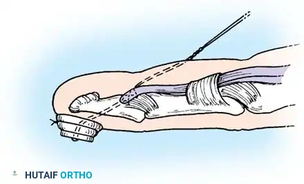 Hutaifortho's Orthopaedic Diagram