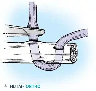 Hutaifortho's Orthopaedic Diagram