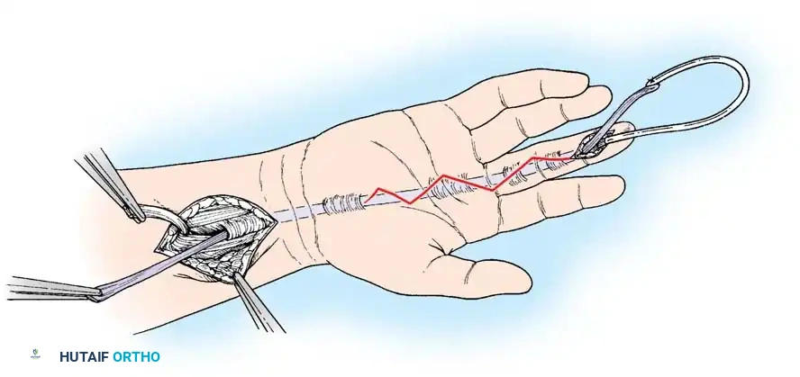 Hutaifortho's Orthopaedic Diagram