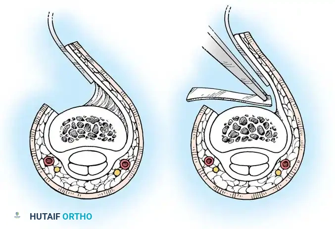 Hutaifortho's Orthopaedic Diagram