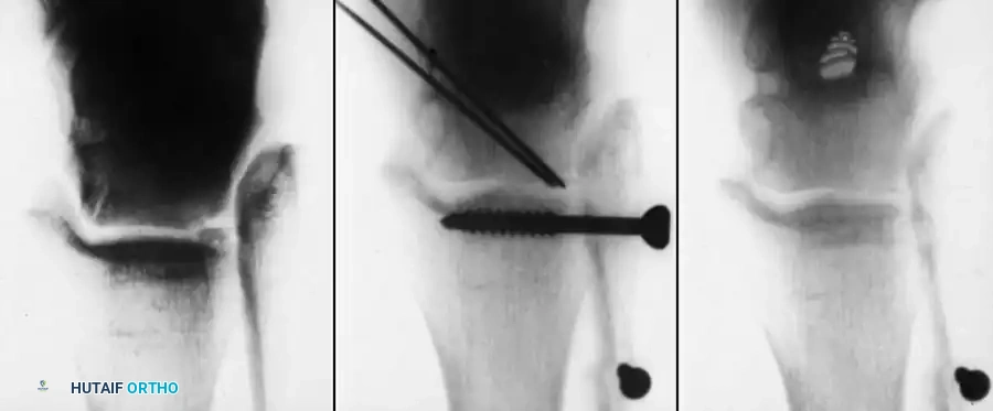 Hutaifortho's Orthopaedic Diagram