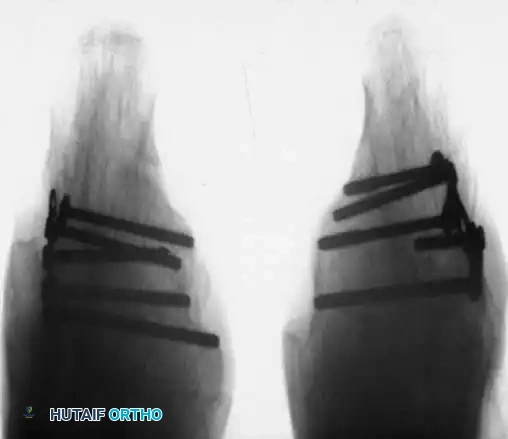 Hutaifortho's Orthopaedic Diagram