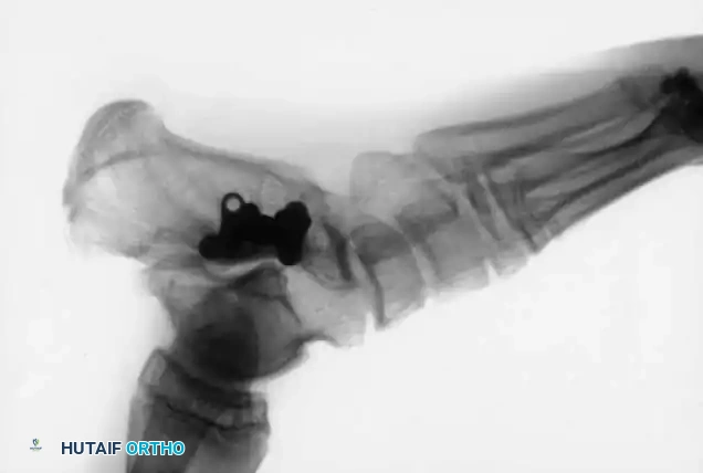 Hutaifortho's Orthopaedic Diagram