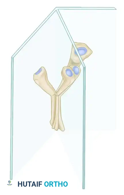 Operative Management of Foot Malunions: Phalanges, Metatarsals, and the Talus
