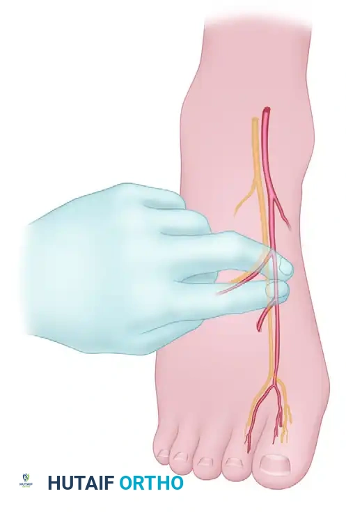 Regional Anesthesia of the Foot and Ankle: Forefoot & Ankle Block Techniques