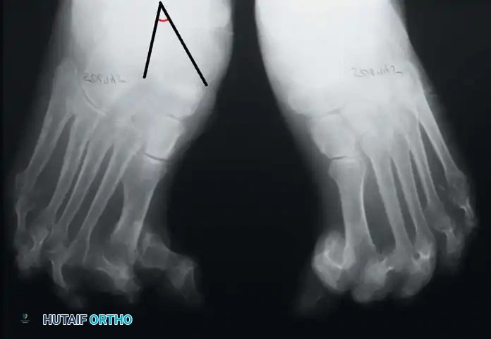 Hutaifortho's Orthopaedic Diagram