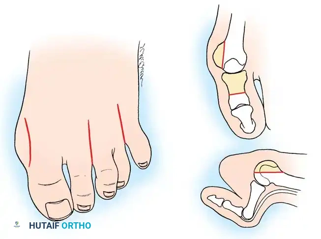 Hutaifortho's Orthopaedic Diagram