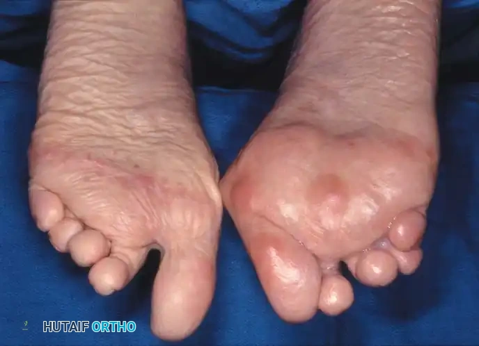 Hutaifortho's Orthopaedic Diagram