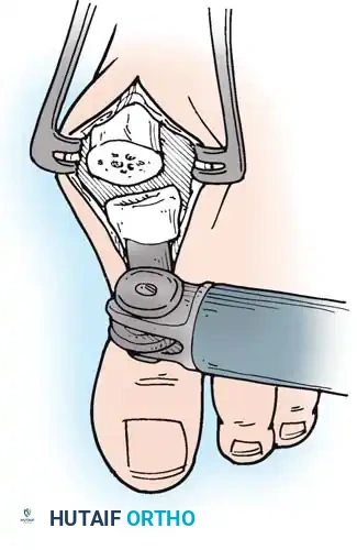 Hutaifortho's Orthopaedic Diagram