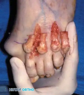 Hutaifortho's Orthopaedic Diagram