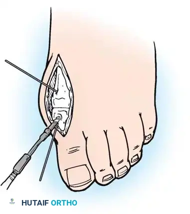 Hutaifortho's Orthopaedic Diagram
