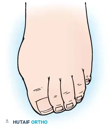Hutaifortho's Orthopaedic Diagram