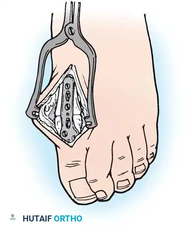 Hutaifortho's Orthopaedic Diagram