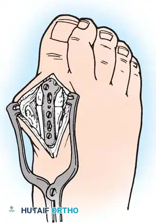 Hutaifortho's Orthopaedic Diagram